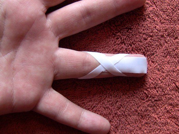Bandaging a blistered or cut finger